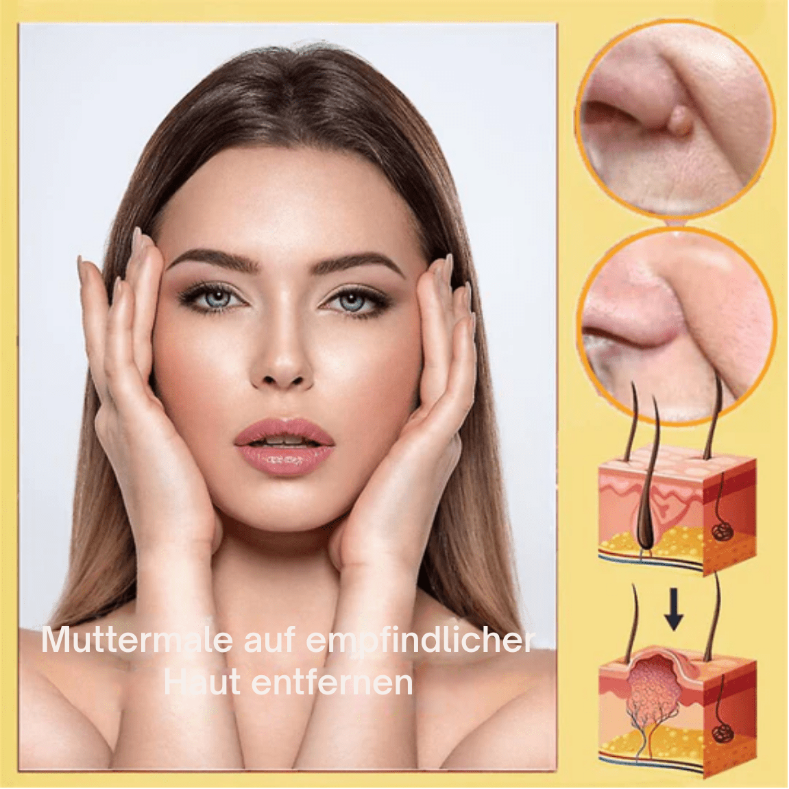 1 + 1 GRATIS | Laura™ Entfernt sanft Hautanhängsel und Flecken - Sopheria