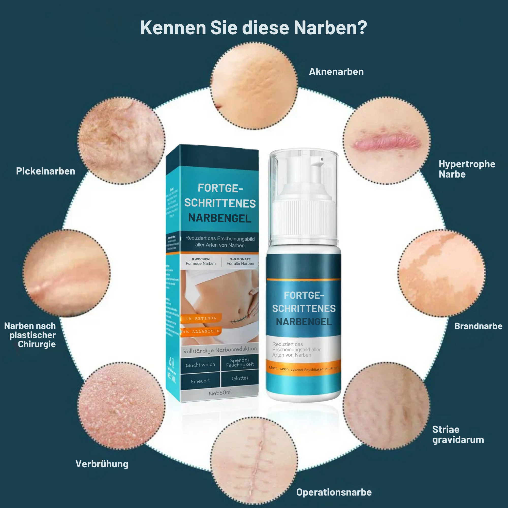 1+1 GRATIS | Littekengel Leonie zur sichtbaren Narbenmilderung