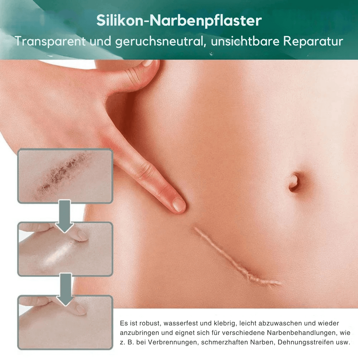 1+1 GRATIS | Narbenglanz™ – Entfernt hartnäckige Narben und mindert Falten - Sopheria
