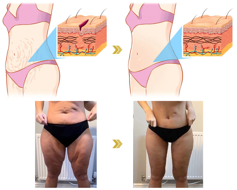 FrischFix™ / Hydratiere Und Verjünge Müde, Alternde Haut In Einem Schritt (1+1 GRATIS)