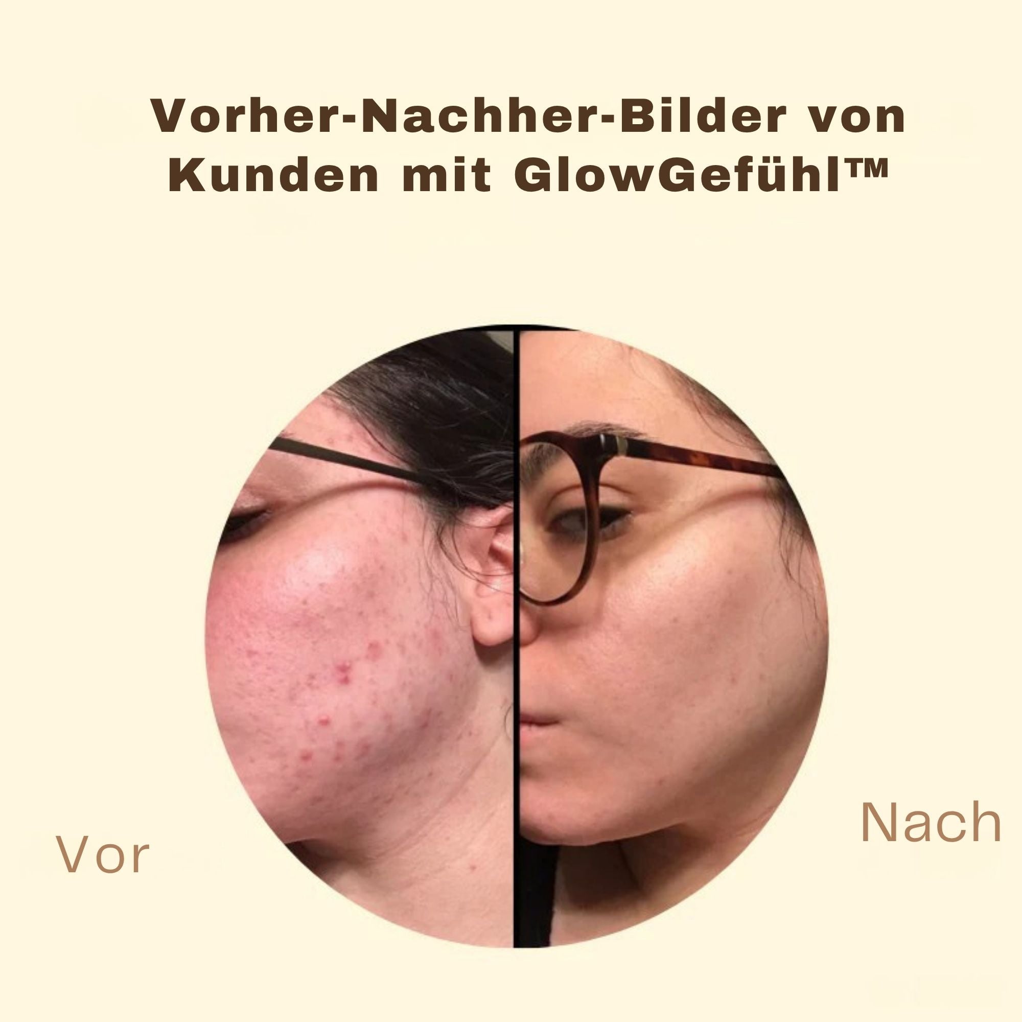 GlowGefühl™ / Schwarze Tee Maske Für Klare, Junge Haut (1+1 GRATIS)