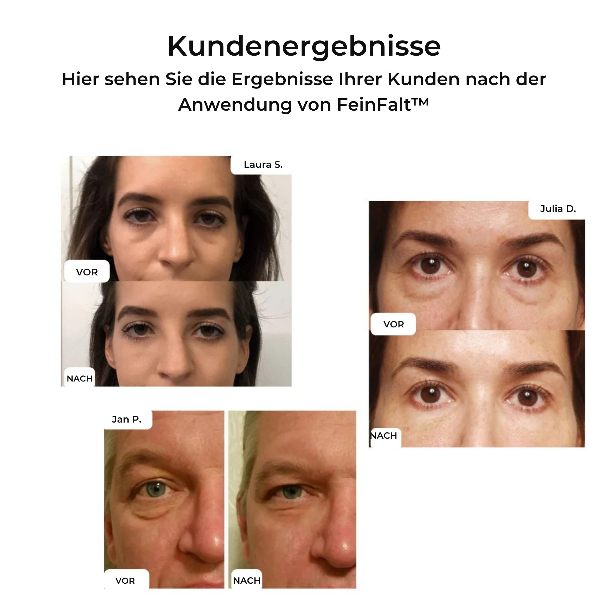 FeinFalt™ / Augenstraffende Creme (1+1 GRATIS)