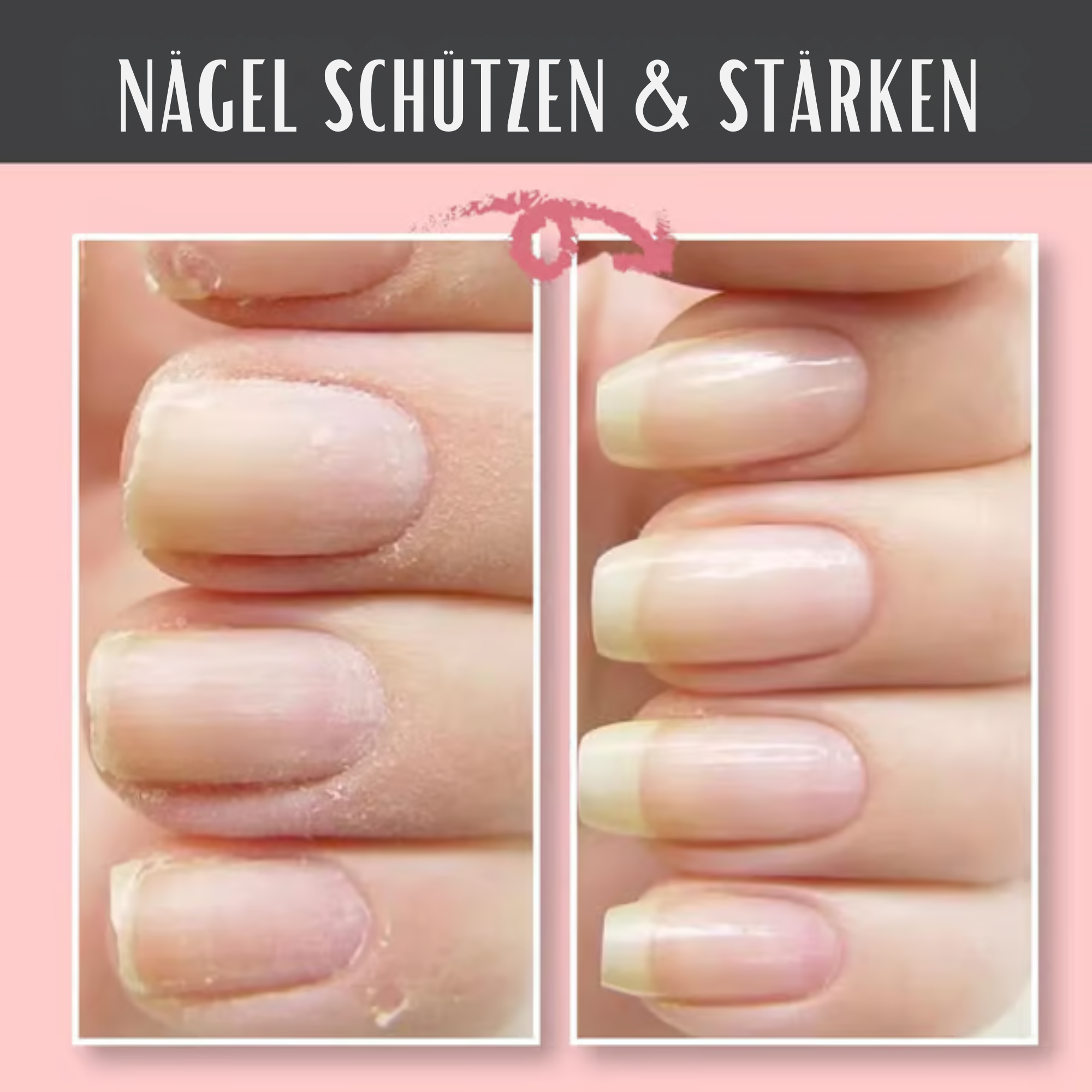 NagelNest™ / Reparierendes Und Schützendes Nagelgel (2+1 GRATIS)