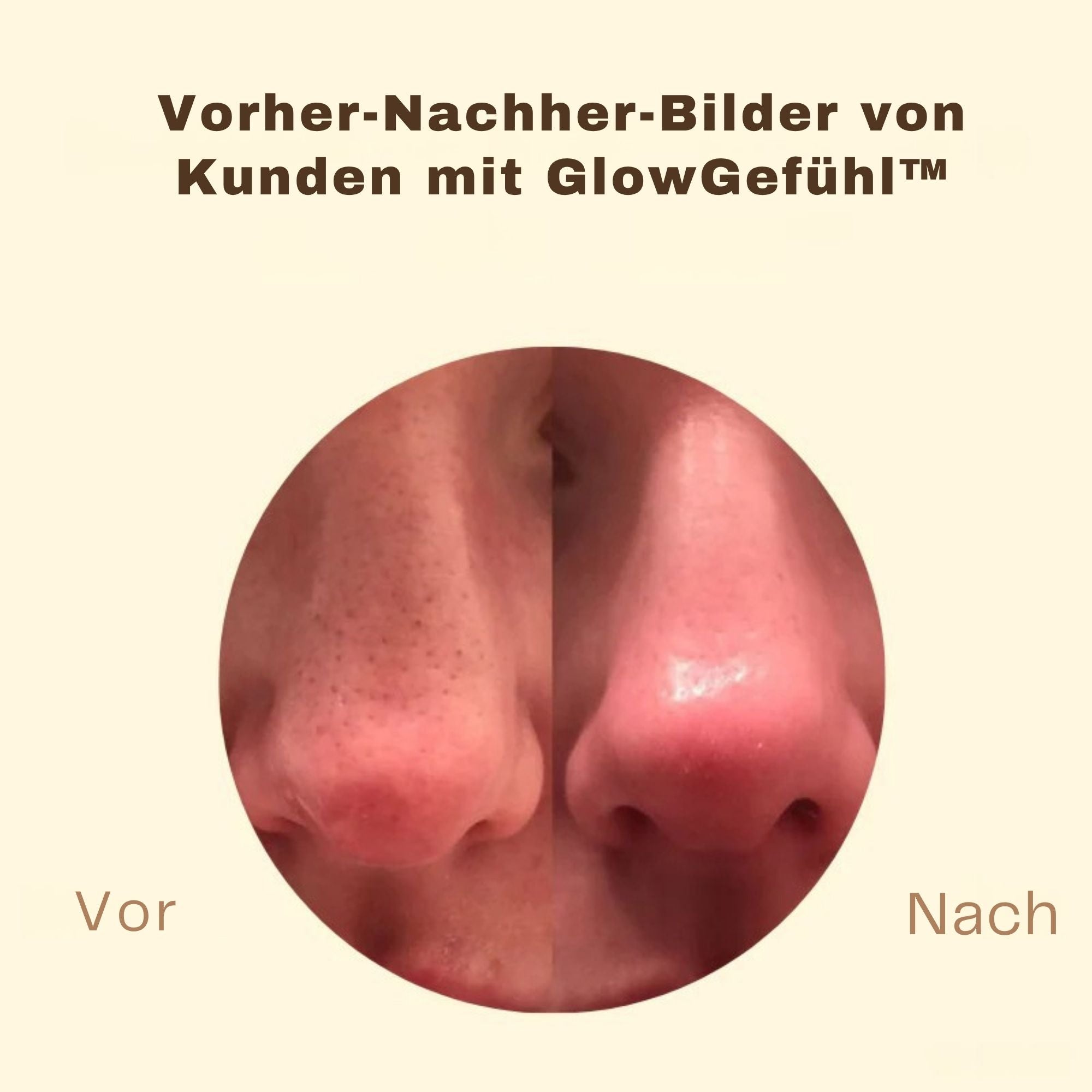 GlowGefühl™ / Schwarze Tee Maske Für Klare, Junge Haut (1+1 GRATIS)