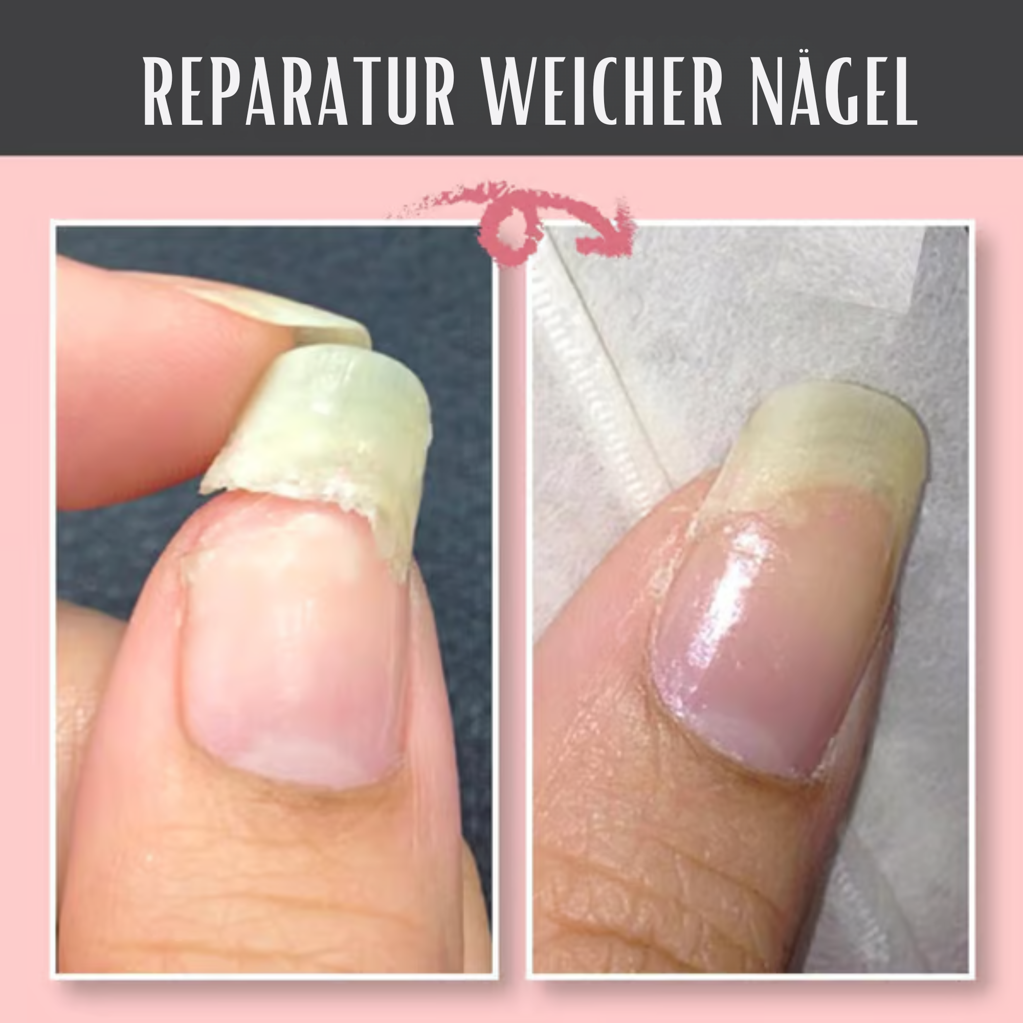 NagelNest™ / Reparierendes Und Schützendes Nagelgel (2+1 GRATIS)