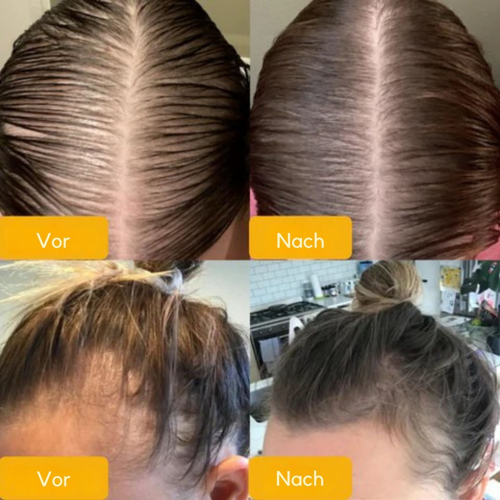 WuchsWunder™ / Ätherisches Öl Für Haarwachstum (1+2 GRATIS)