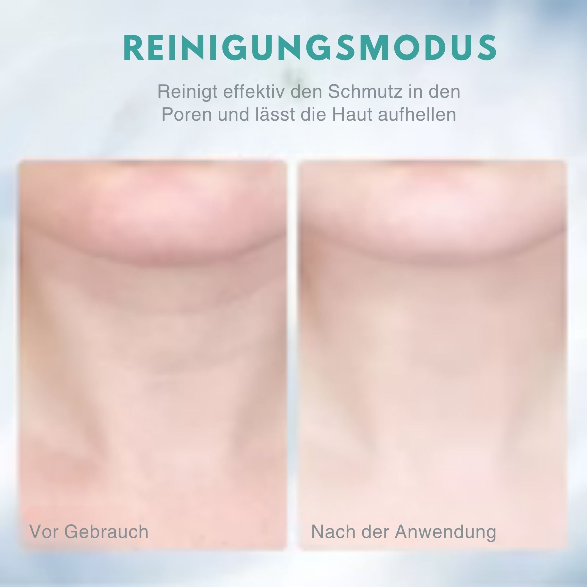 StraffSchimmer™ / Anti-Falten- Und Lifting-Massager