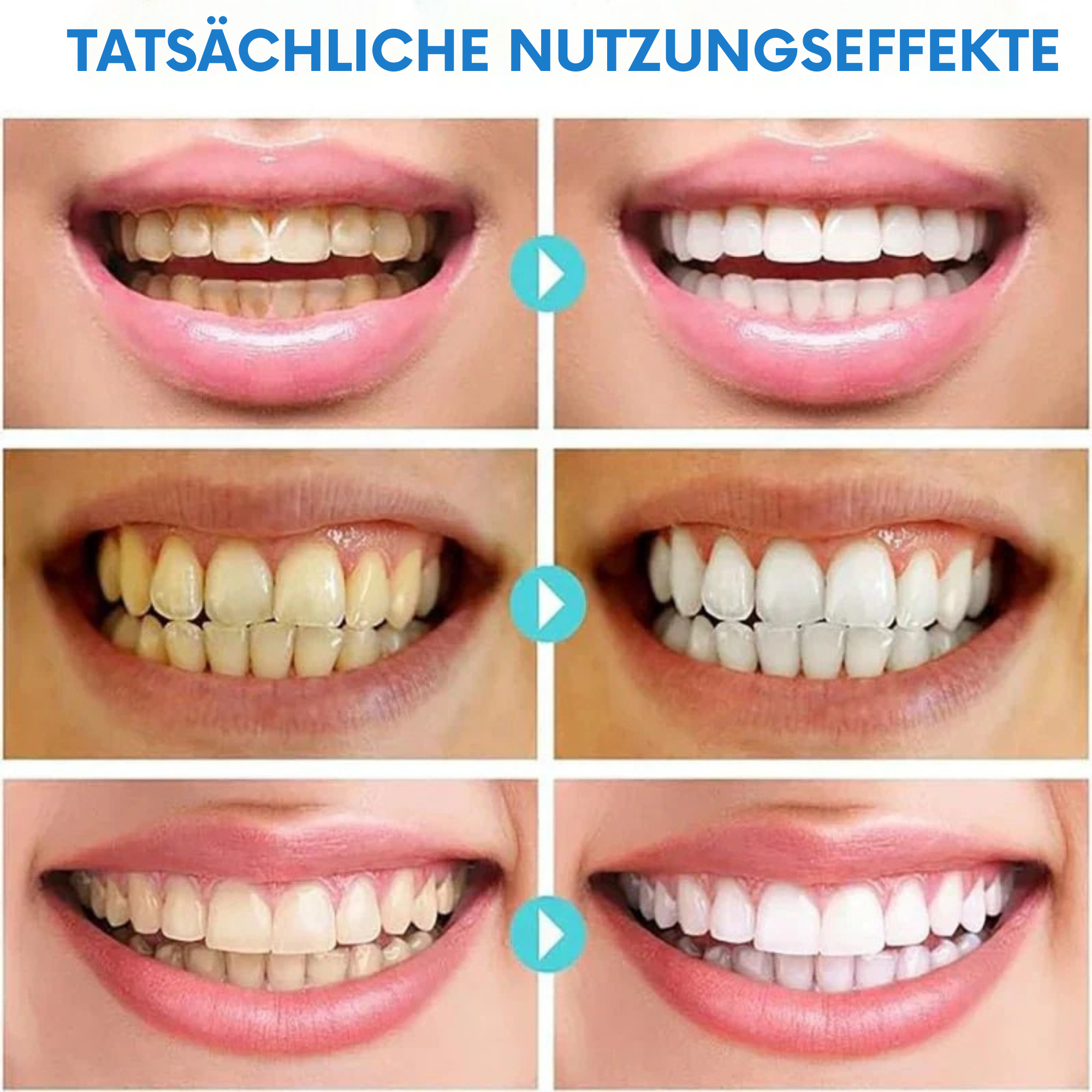 LächelLicht™ / Entfernt Hartnäckige Flecken