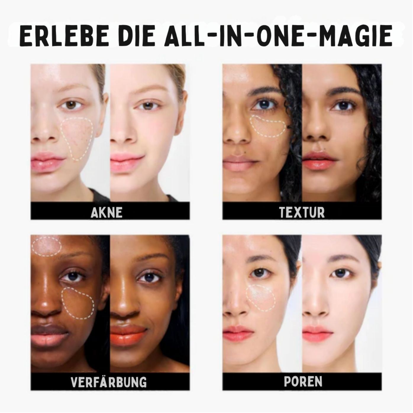 TeintTreff™ / Dreifarbiger Concealer