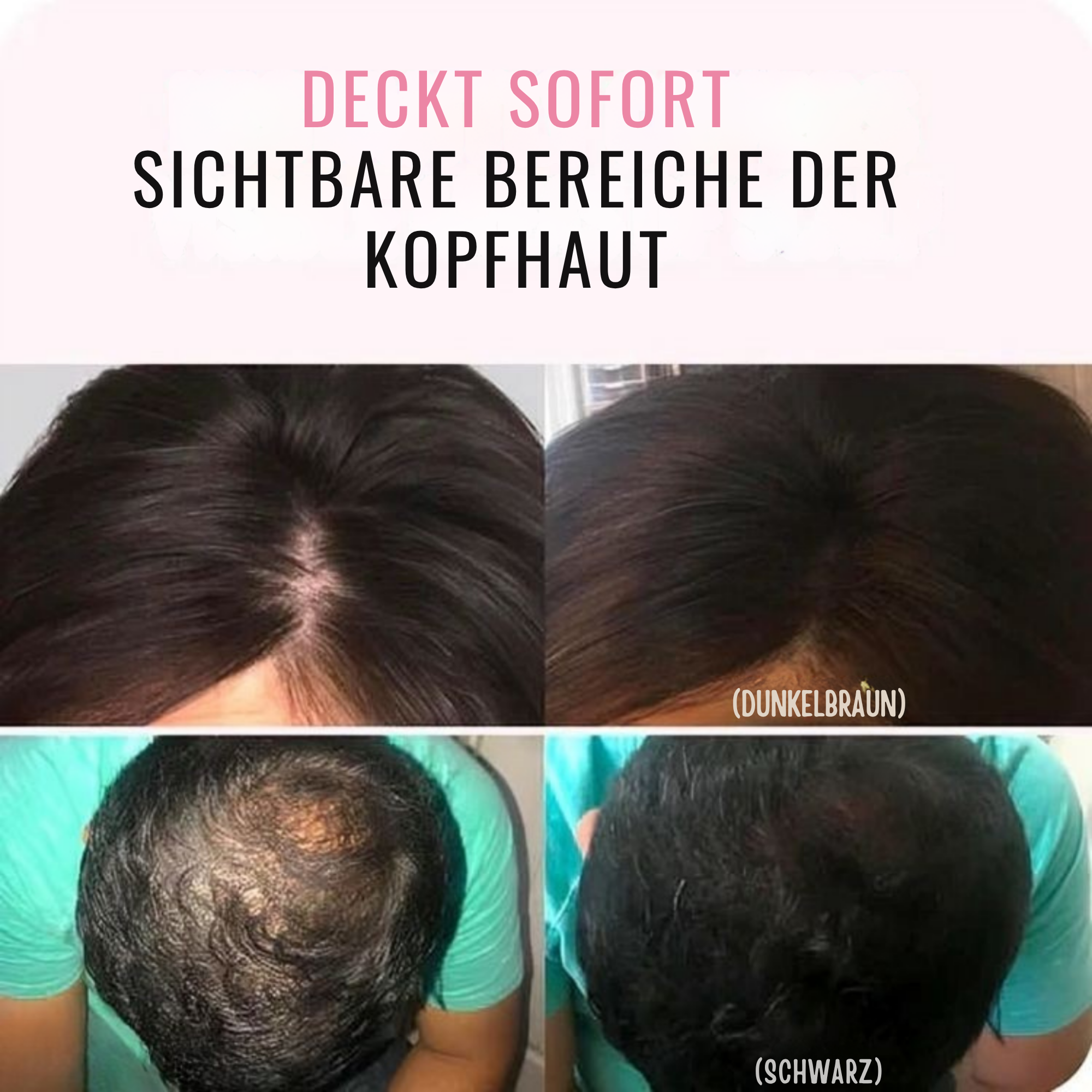 WurzelWunder™ / Kein Nachwachsen Mehr! (1+1 GRATIS)