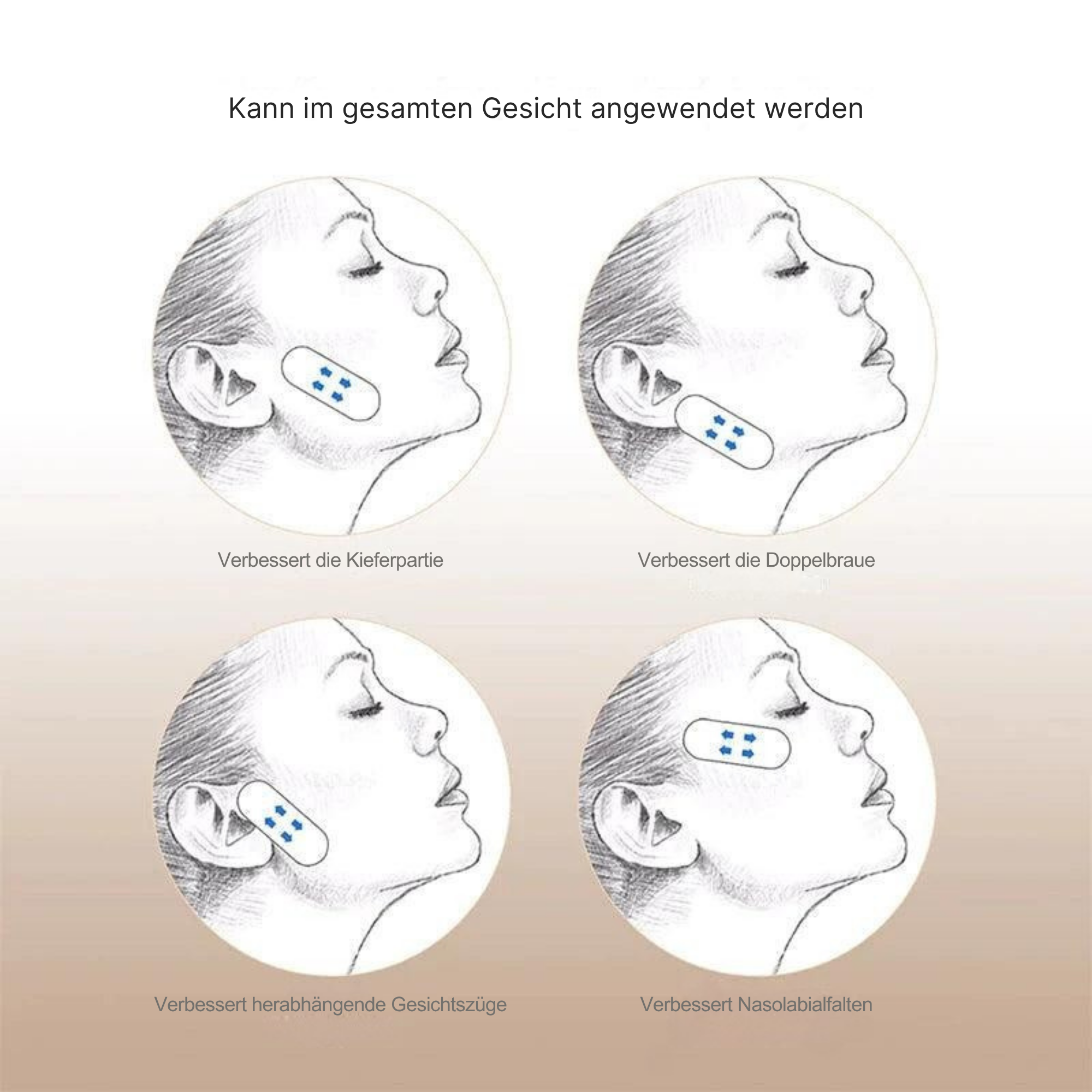 Gabriele – Sofortige Gesichtsstraffung
