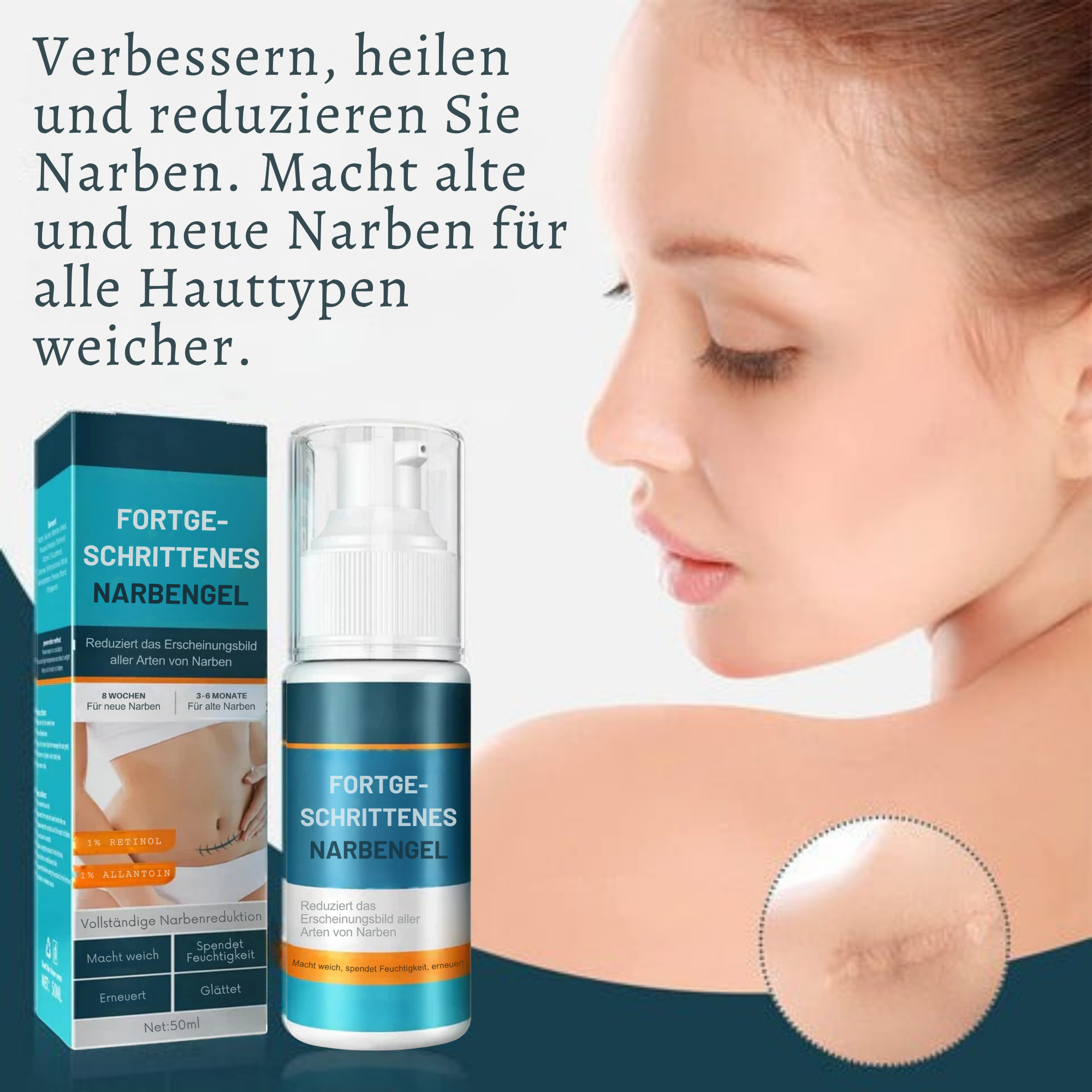 1+1 GRATIS | Littekengel Leonie zur sichtbaren Narbenmilderung