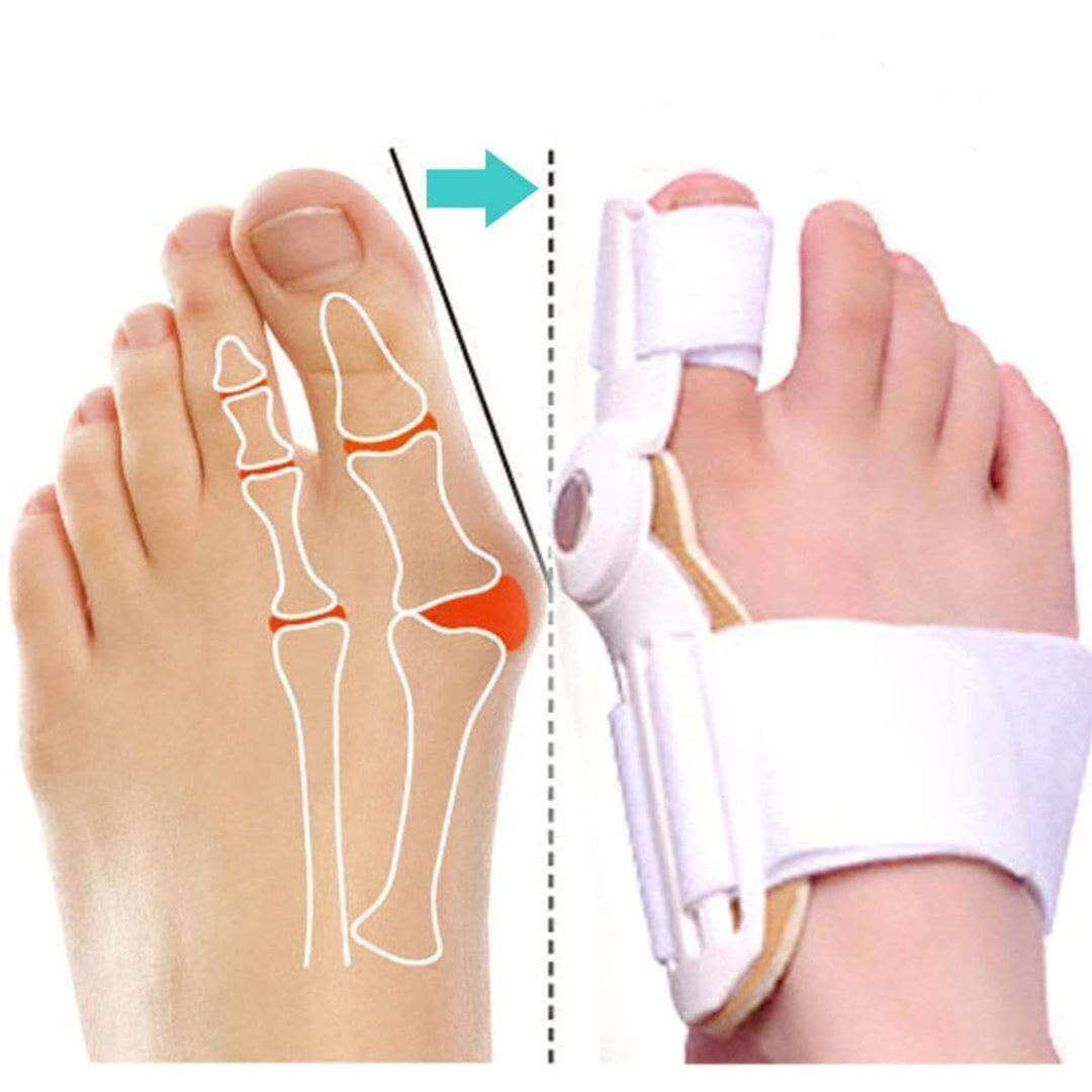 ZehenZentrix™ / Orthopädischer Gelenkiger Hallux-Valgus-Korrektor (1+2 GRATIS)