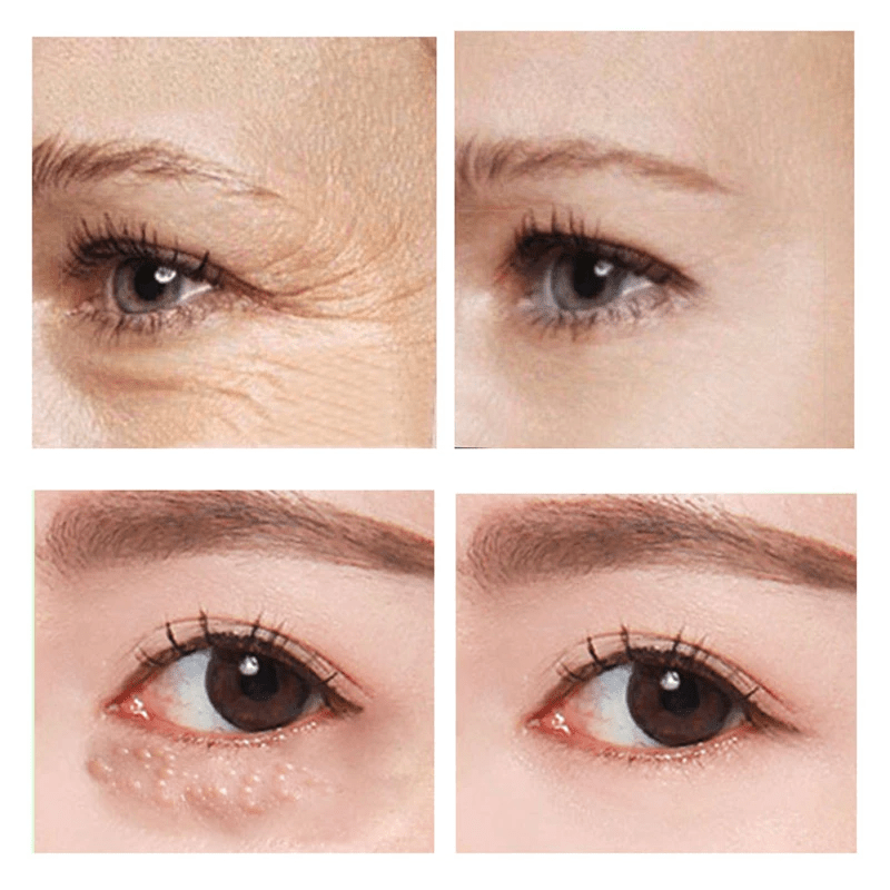 1 + 1 GRATIS | Hannah™ Direkt liftende Augencreme