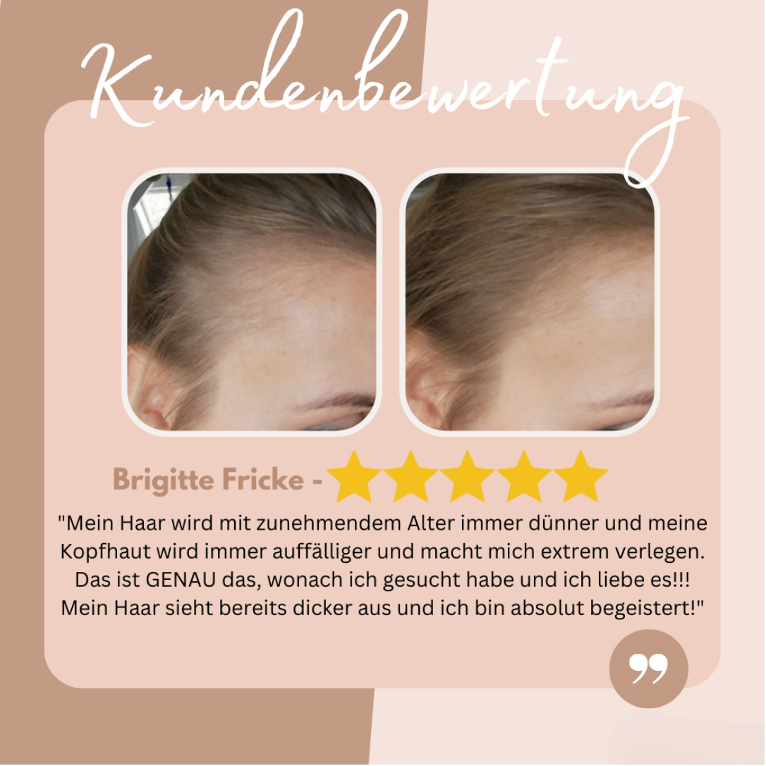 AnsatzAde™ / Sag Lebewohl zu Deinem Haaransatz! (1+1 GRATIS)