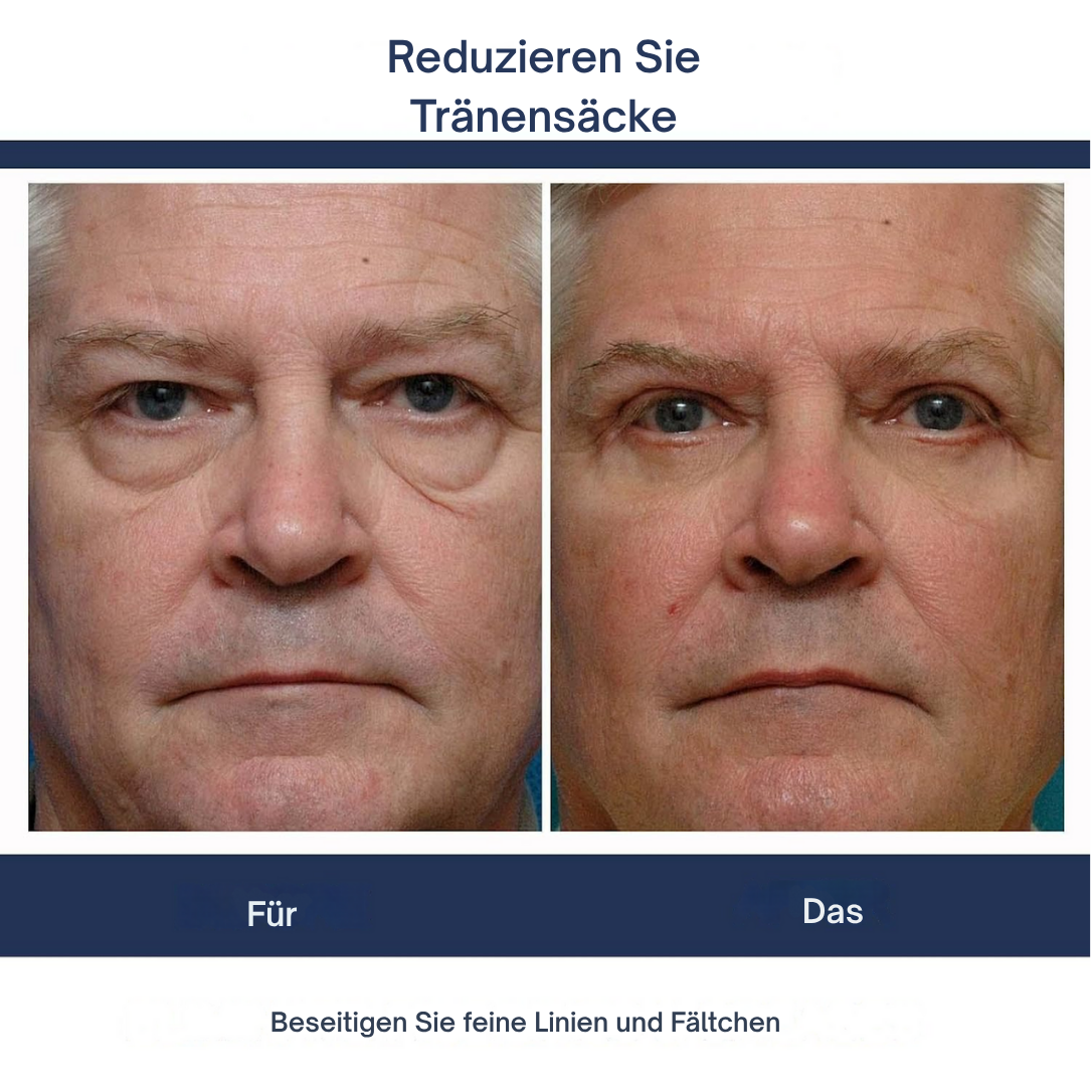 1 + 1 GRATIS | Leon⢠Verjßngendes Augenlifting-Gel fßr Männer und Frauen