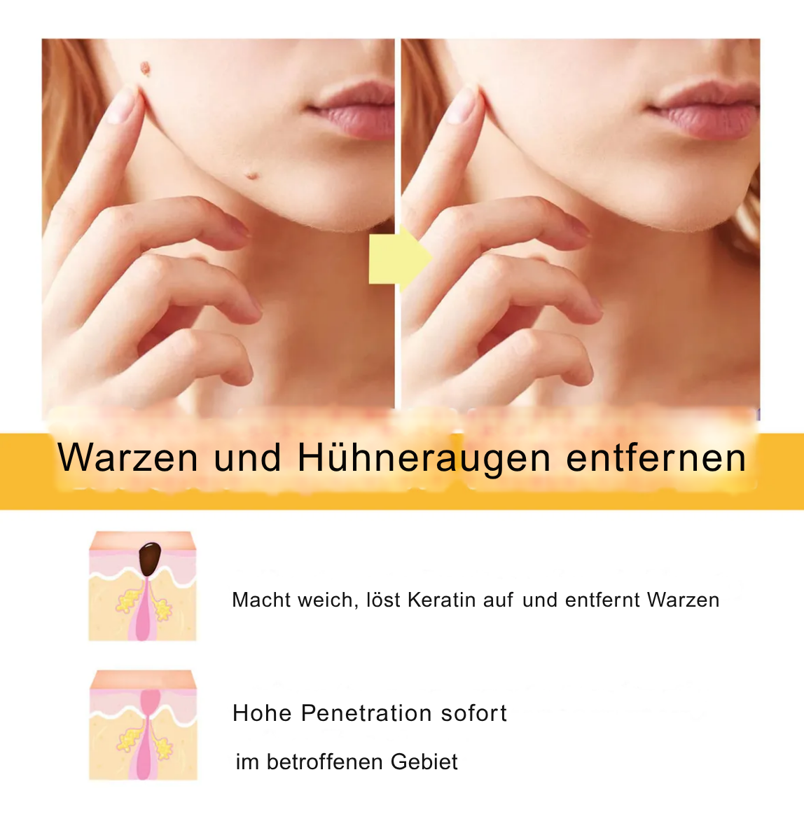 1 + 1 GRATIS | Laura™ Entfernt sanft Hautanhängsel und Flecken
