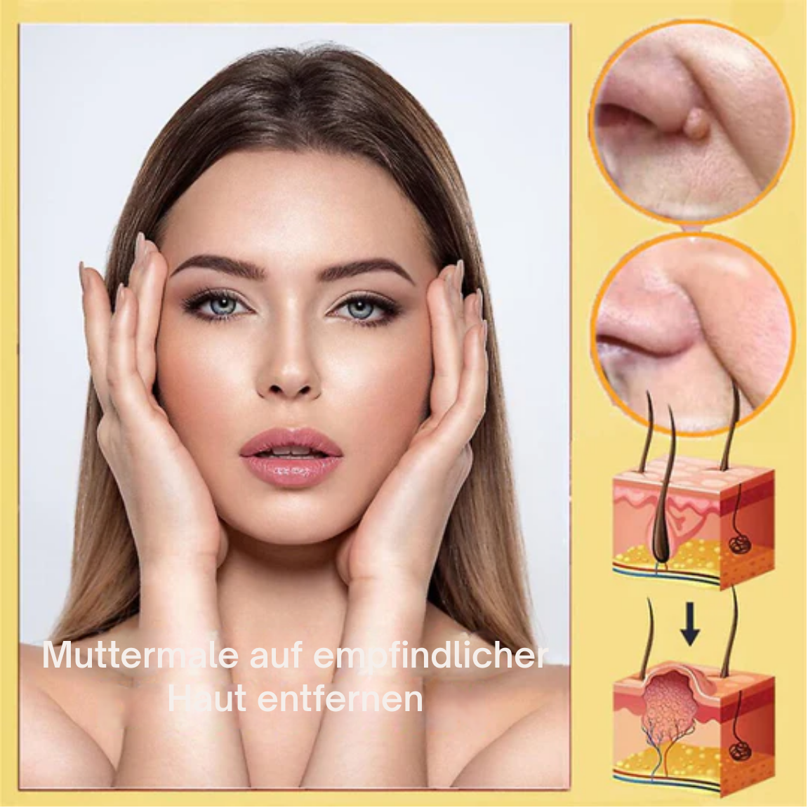 1 + 1 GRATIS | Laura™ Entfernt sanft Hautanhängsel und Flecken