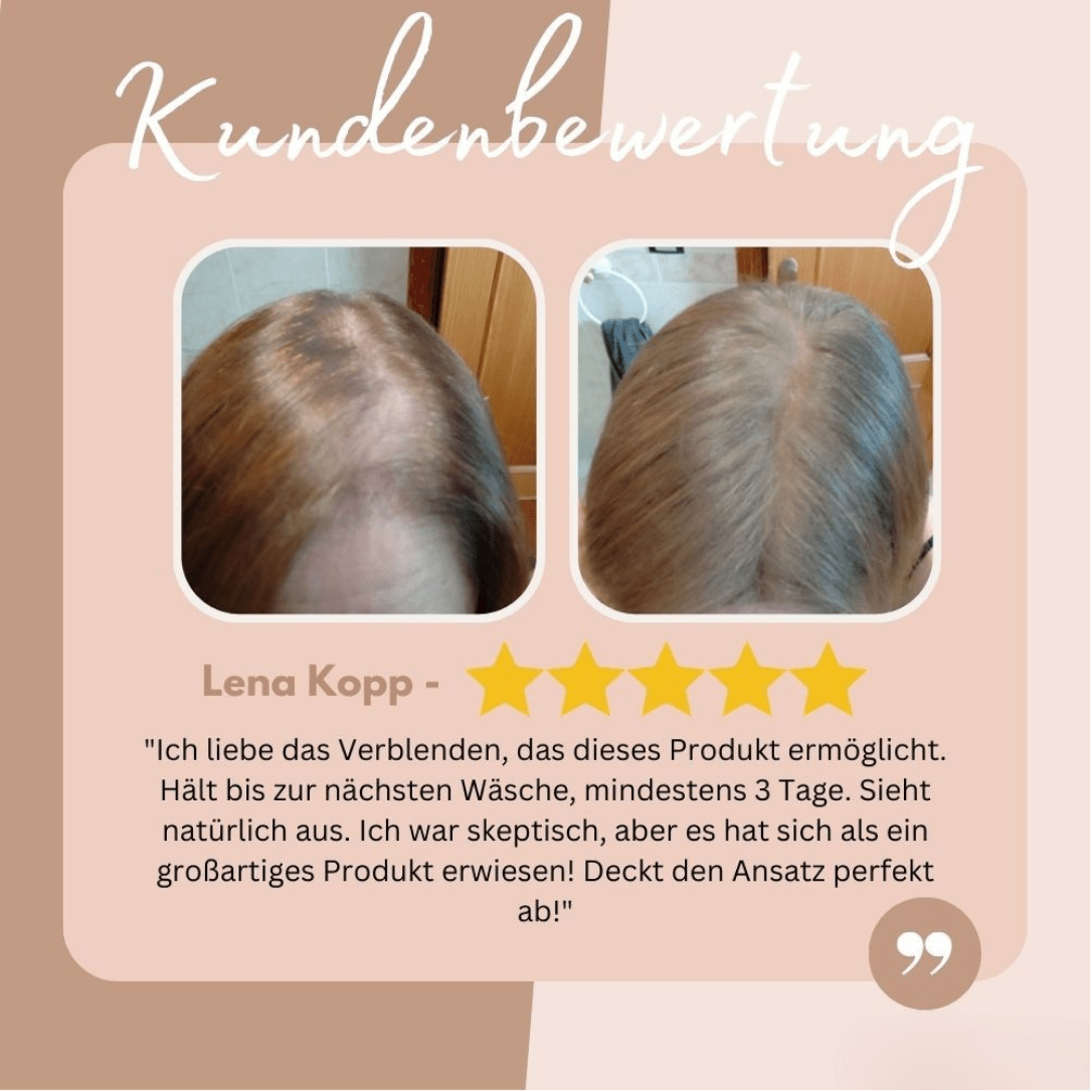 AnsatzAde™ / Sag Lebewohl zu Deinem Haaransatz! (1+1 GRATIS) - Sopheria