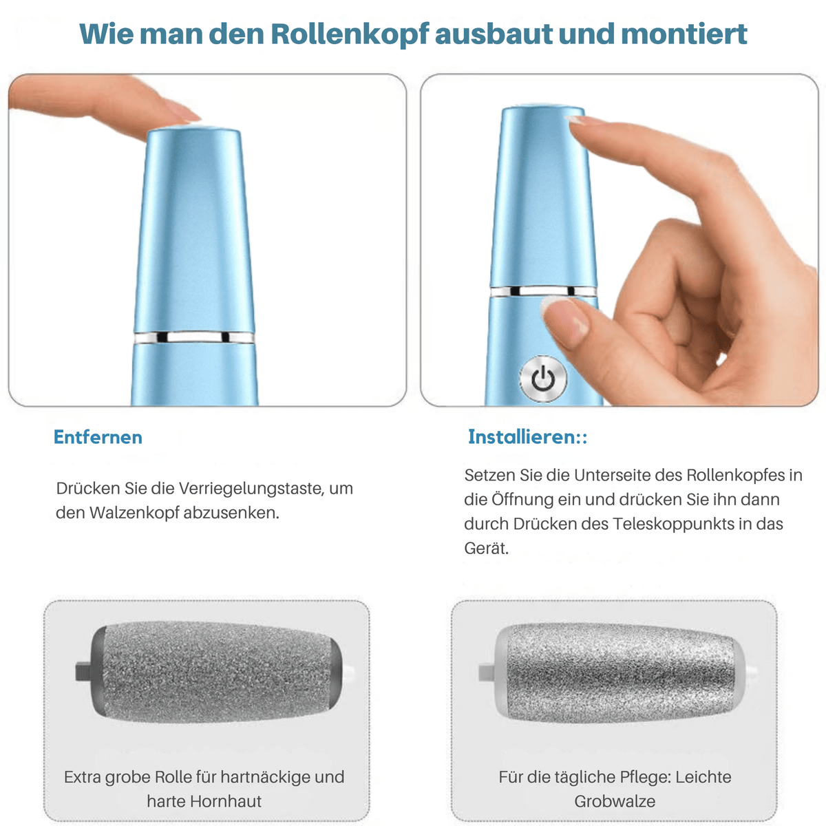 FeenFuß™ / Elektrischer Hornhautentferner - Sopheria