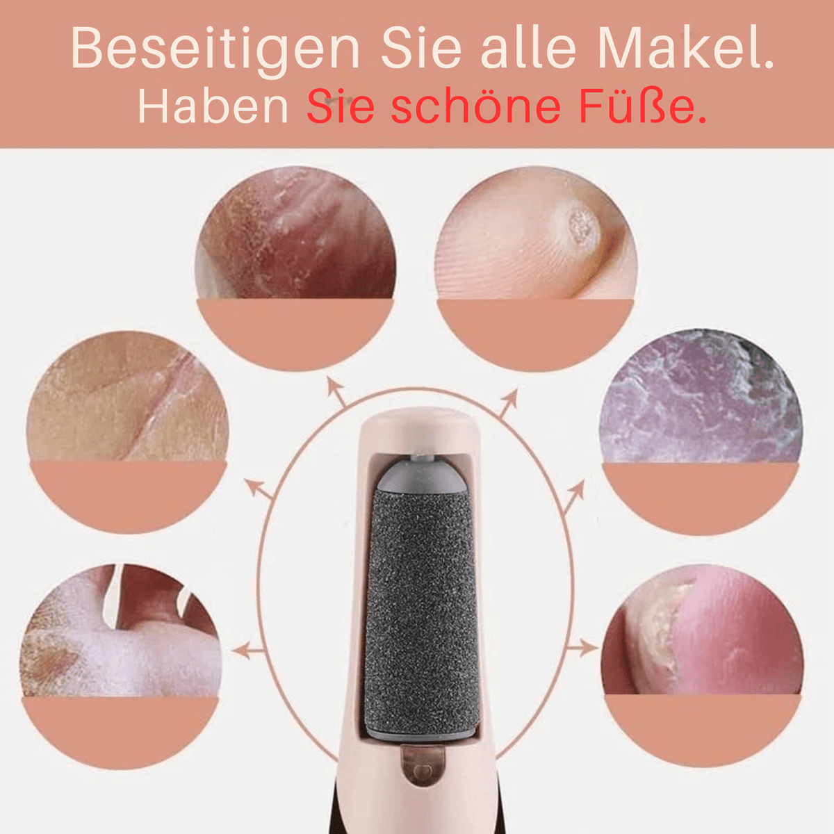 FeenFuß™ / Elektrischer Hornhautentferner - Sopheria
