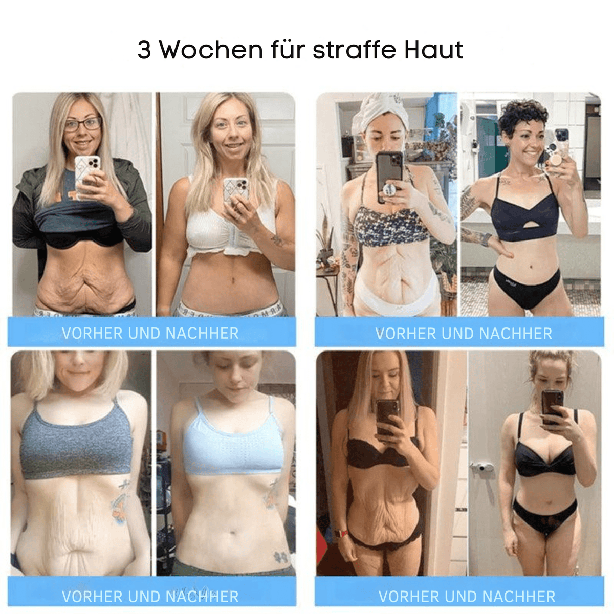 FormFrische™ / Glättet und strafft Ihre Haut auf natürliche Weise - Sopheria