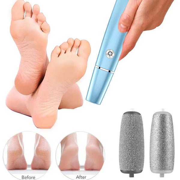 GlattGeh™ / Elektrischer Hornhautentferner - Sopheria