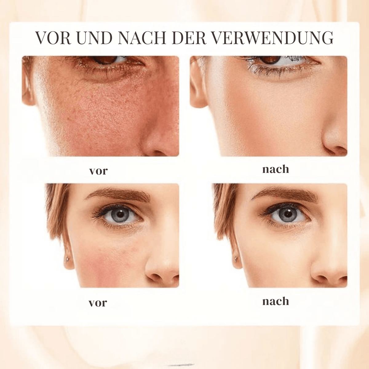 GlowGenie™ / Die Revolution für reife Haut – für strahlende Jugend (1+1 GRATIS) - Sopheria