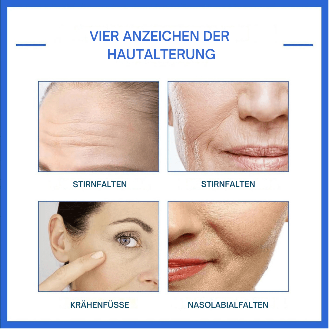 HautHoffnung™ / Für Ein Jüngeres Aussehen Ohne Operation (1+1 GRATIS) - Sopheria