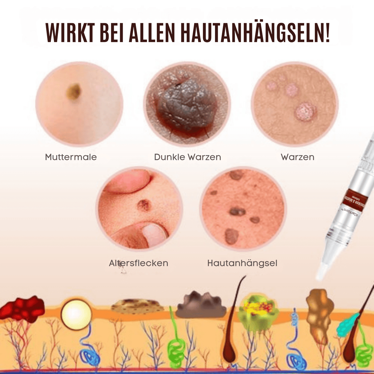 KlarKorn™ / Entfernen Sie Hautflecken auf natürliche und schnelle Weise (1 + 1 GRATIS) - Sopheria
