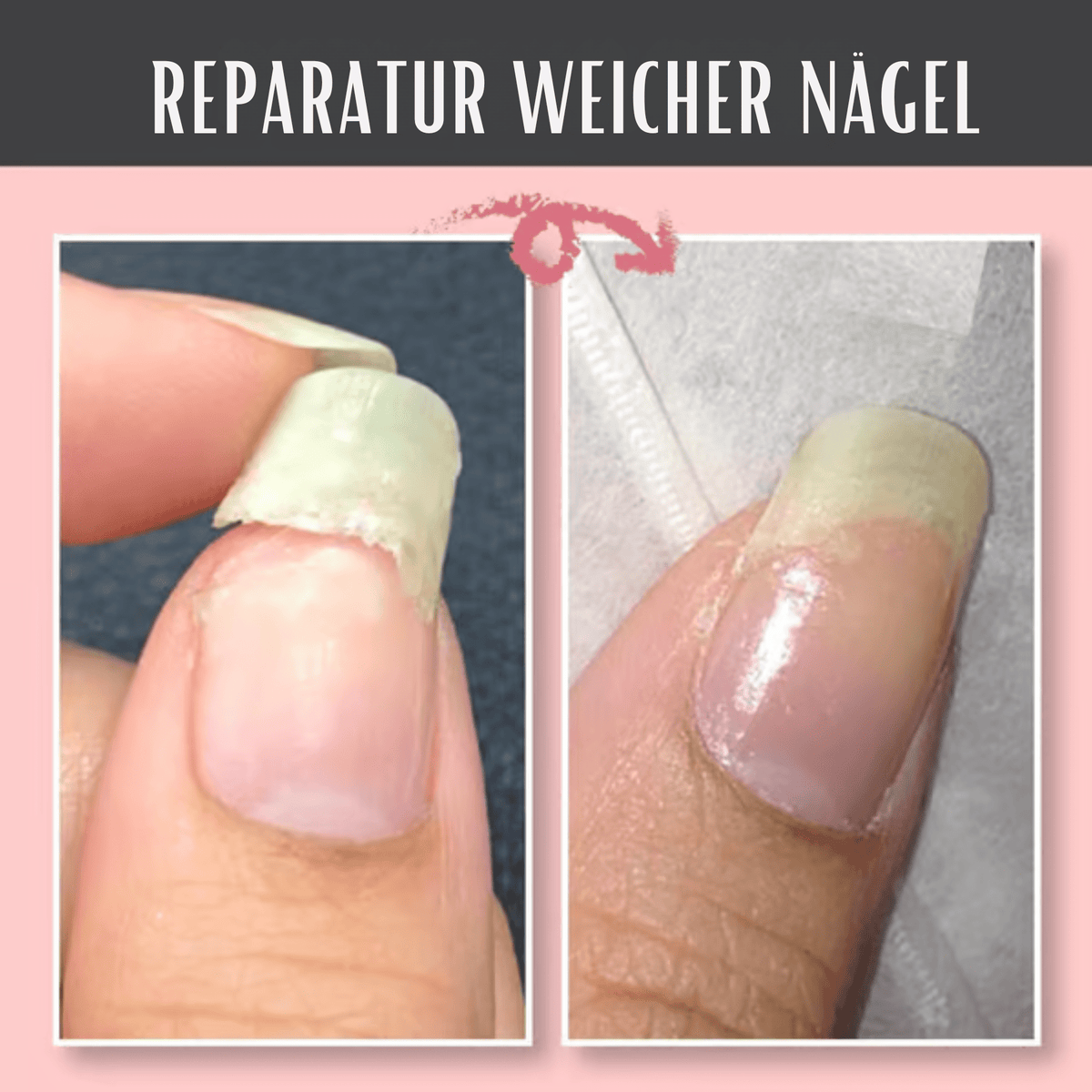 NagelNest™ / Reparierendes Und Schützendes Nagelgel - Sopheria