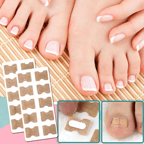 PediPure™ / Nagelkorrektur-Patches (100 Stück) - Sopheria