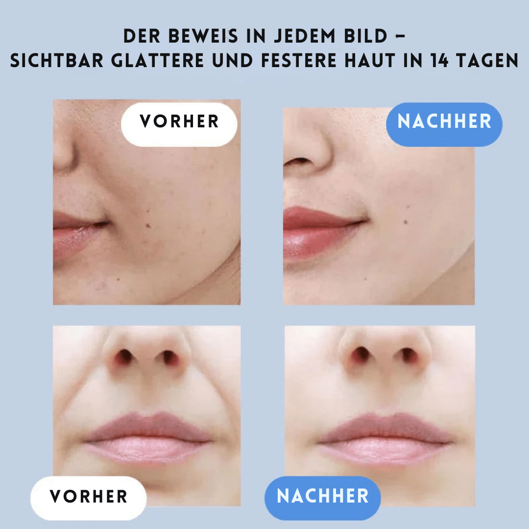 RadiantRaffinesse™ / Leuchtende Haut mit sofortigem Straffungsgefühl - Sopheria