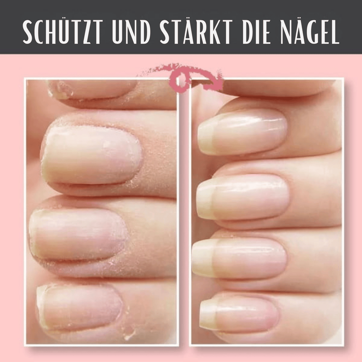 RissRetter™ / Nagelreparatur-Schutzgel - Sopheria