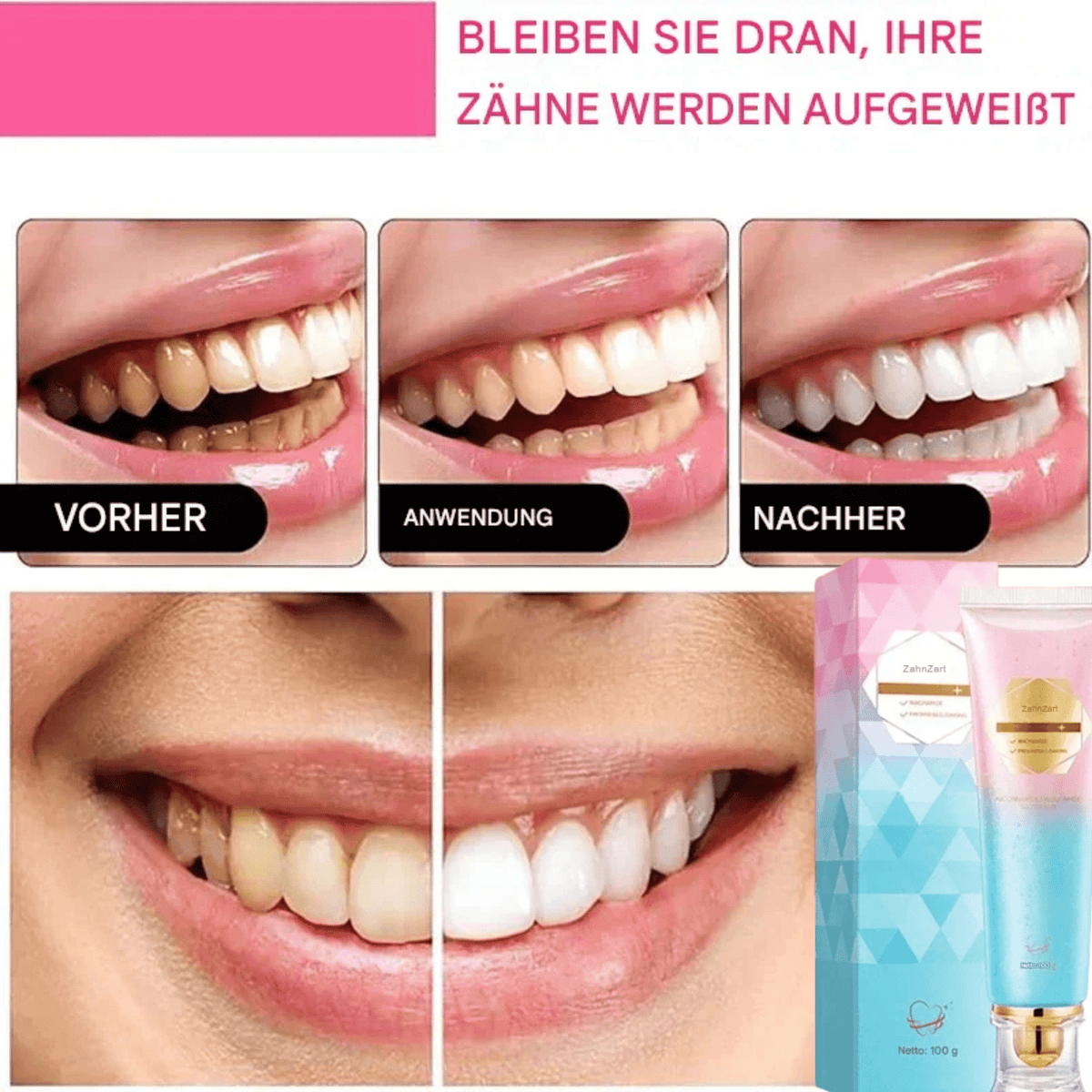 ZahnZart™ / Sofortige Aufhellung - Sopheria