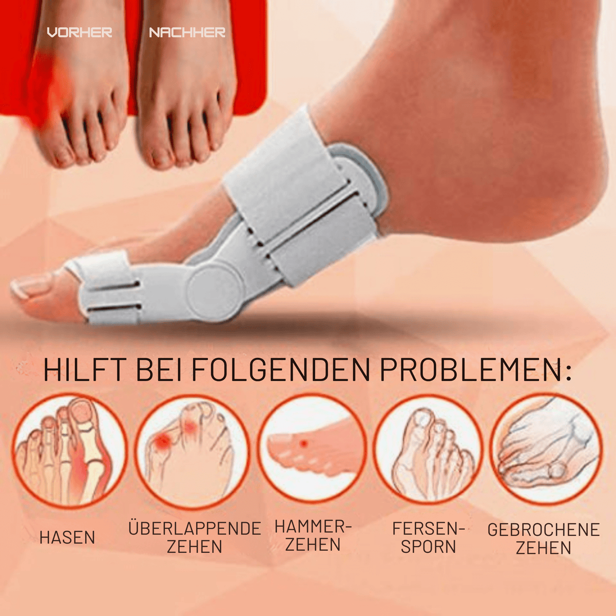 ZehenZentrix™ / Orthopädischer Gelenkiger Hallux-Valgus-Korrektor (1+2 GRATIS) - Sopheria