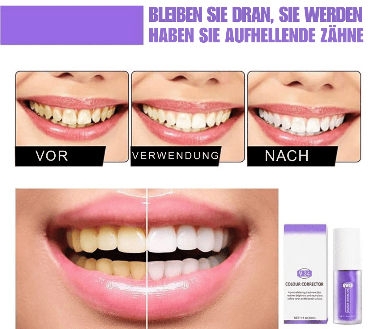 1 + 1 GRATIS | Lilly™ Fühle dich selbstbewusster mit einem frischen, strahlenden Lächeln, das lange anhält - Sopheria