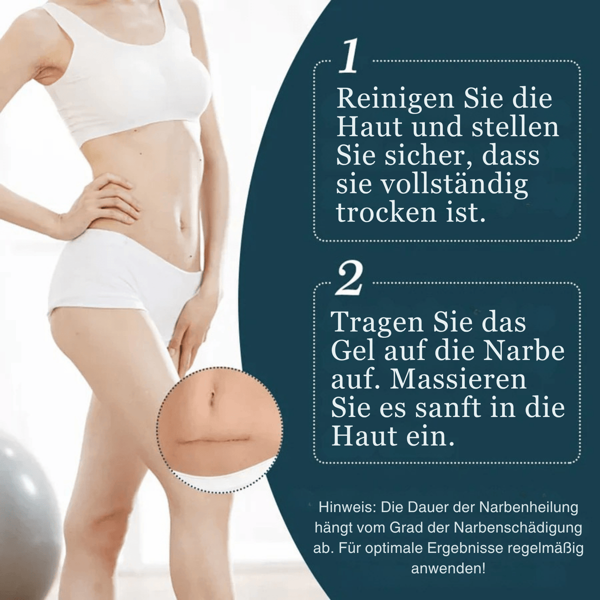 1+1 GRATIS | Littekengel Leonie zur sichtbaren Narbenmilderung - Sopheria