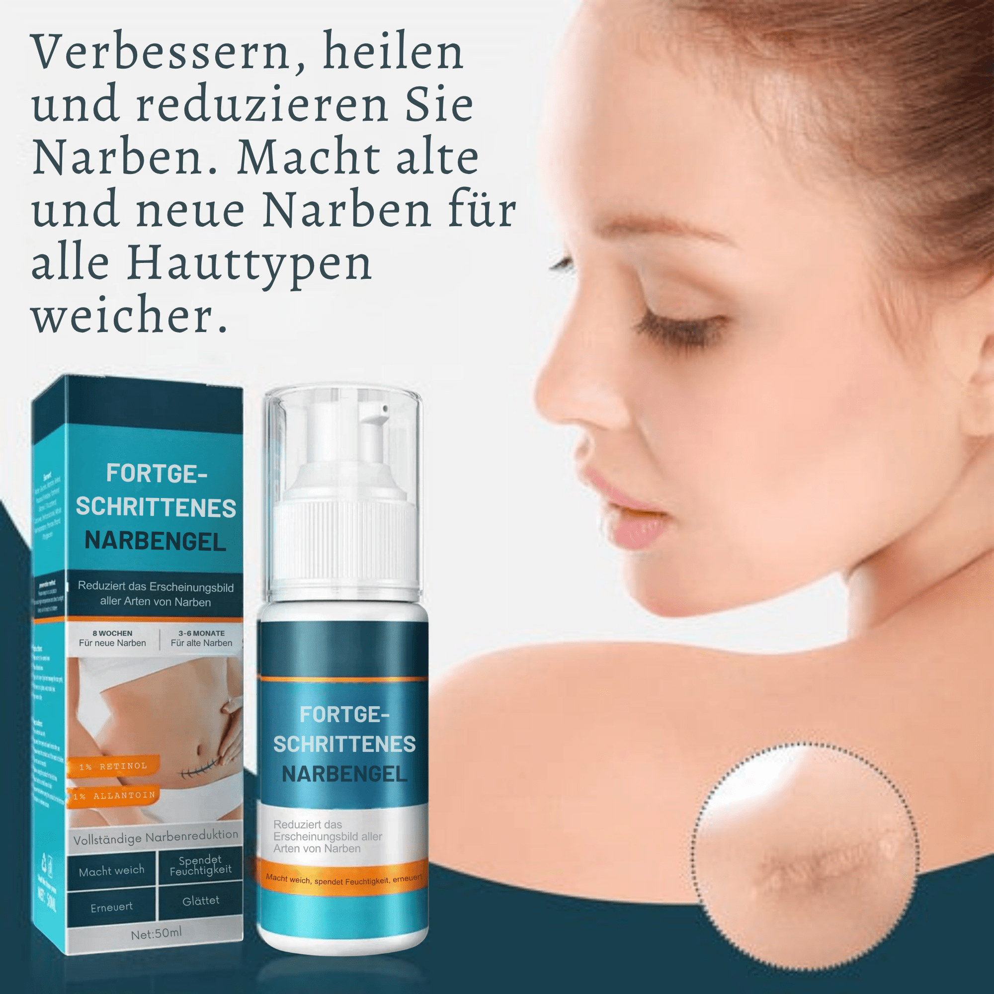 1+1 GRATIS | Littekengel Leonie zur sichtbaren Narbenmilderung - Sopheria