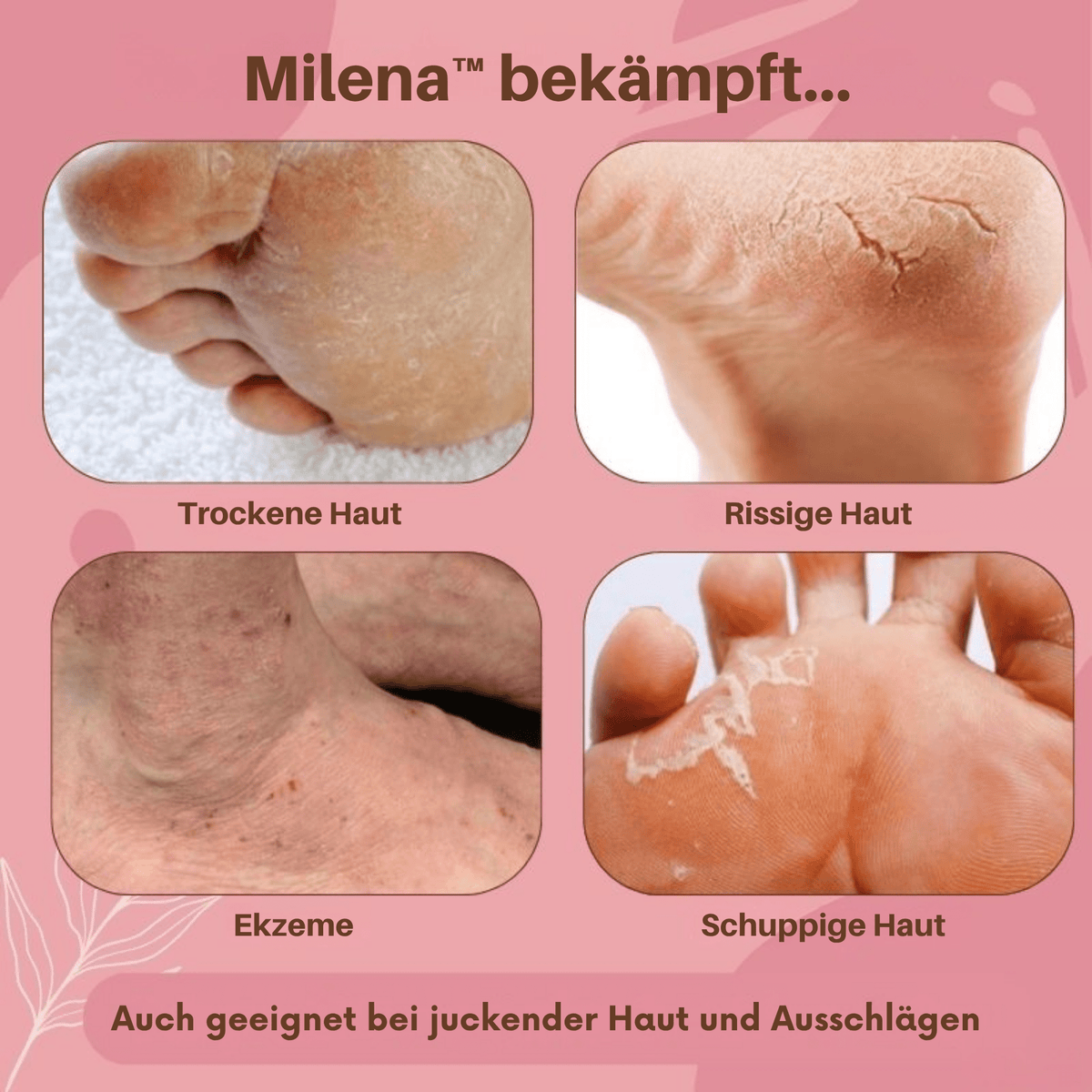 1+1 GRATIS | Milena - Fußerneuernde Pflegesalbe gegen Trockenheit, Geruch & Ekzeme - Sopheria