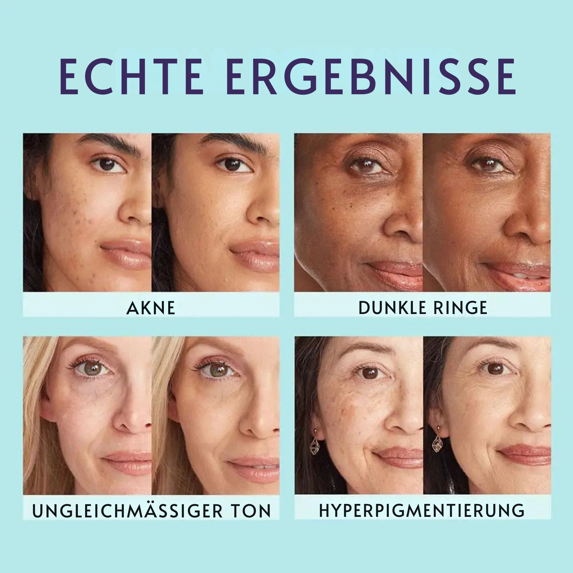 DeckDiva™ / Strahlende, Makellose Haut Entdecken (1+1 Gratis)