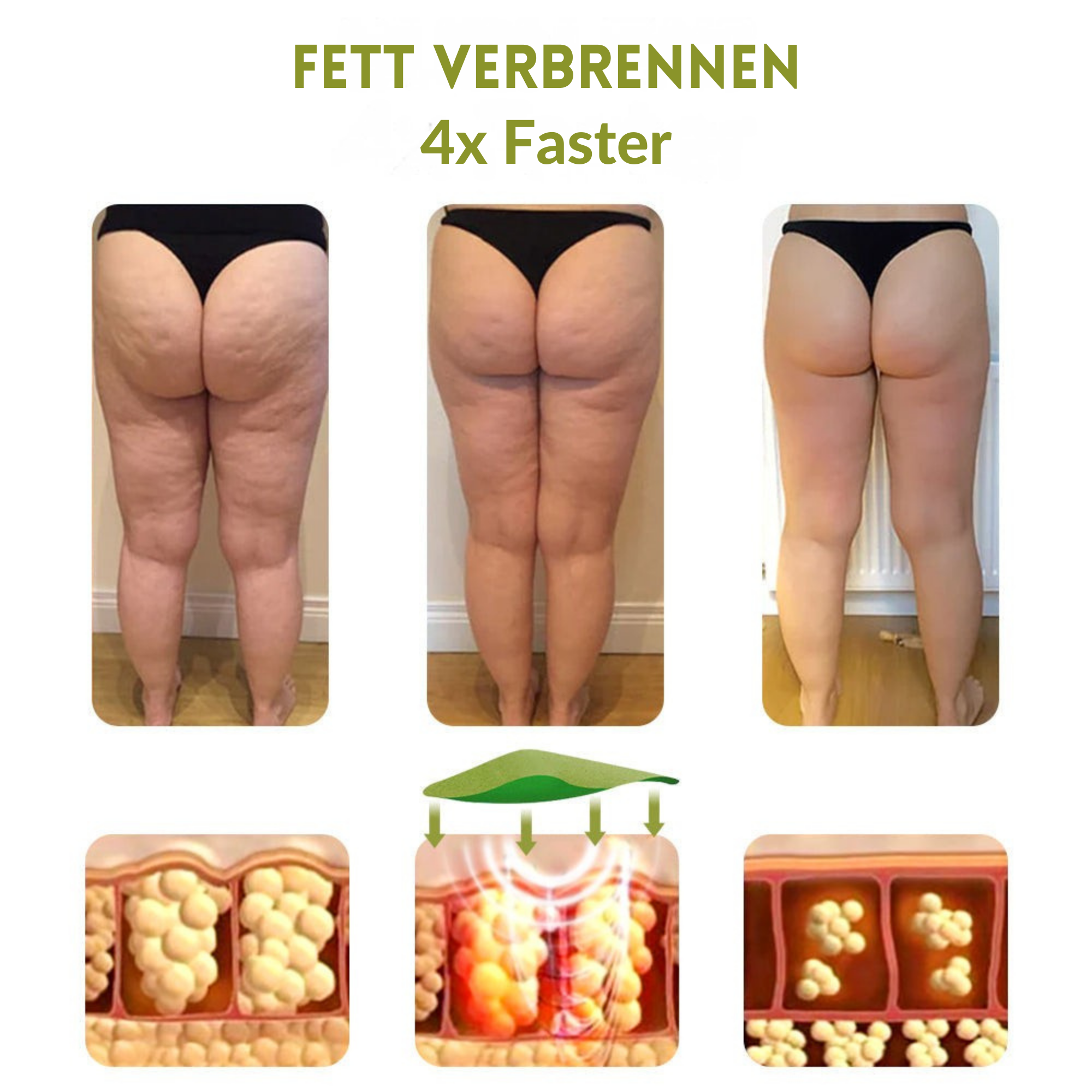 CelluZauber™ / Lösung zur Reduzierung von Cellulite