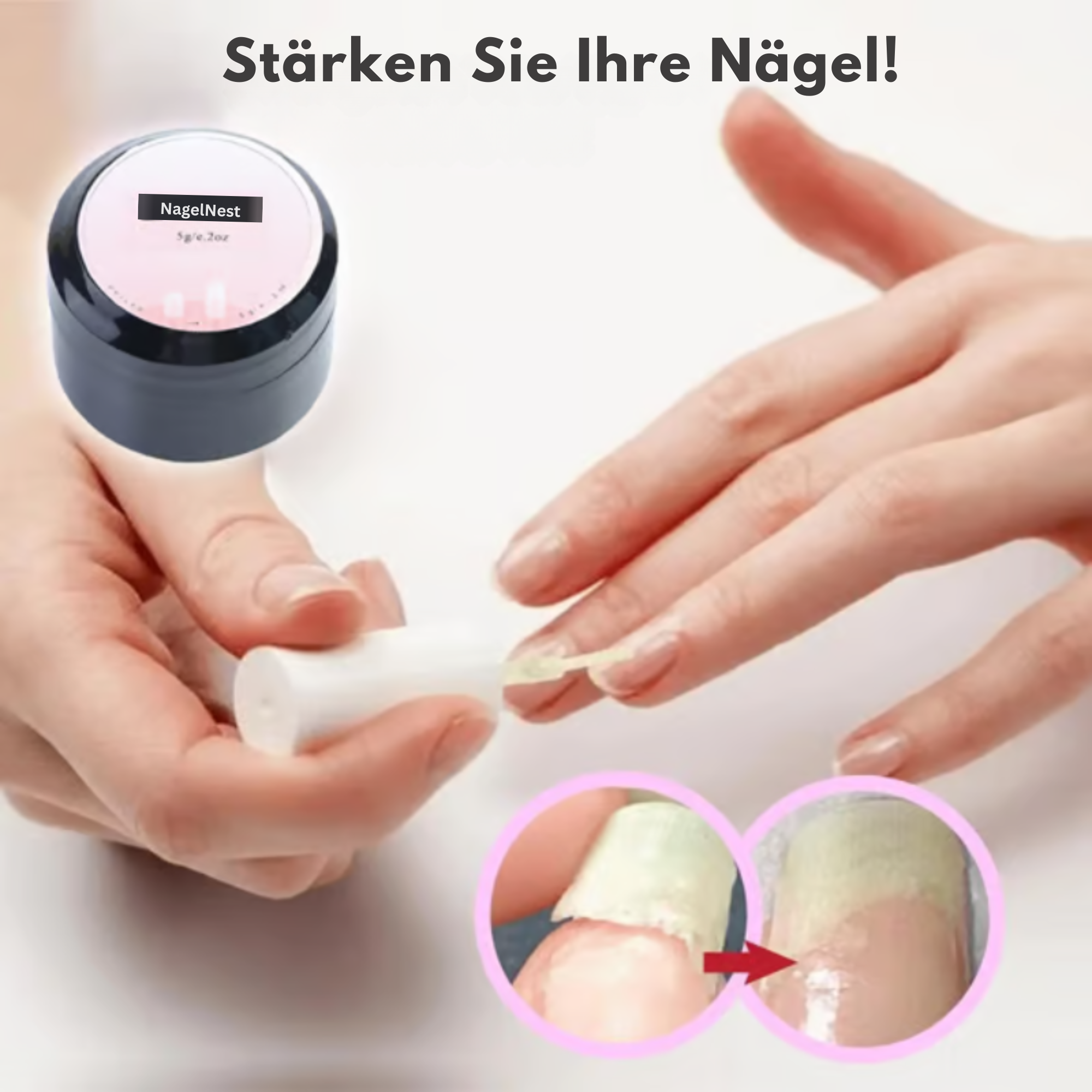 NagelNest™ / Reparierendes Und Schützendes Nagelgel (2+1 GRATIS)