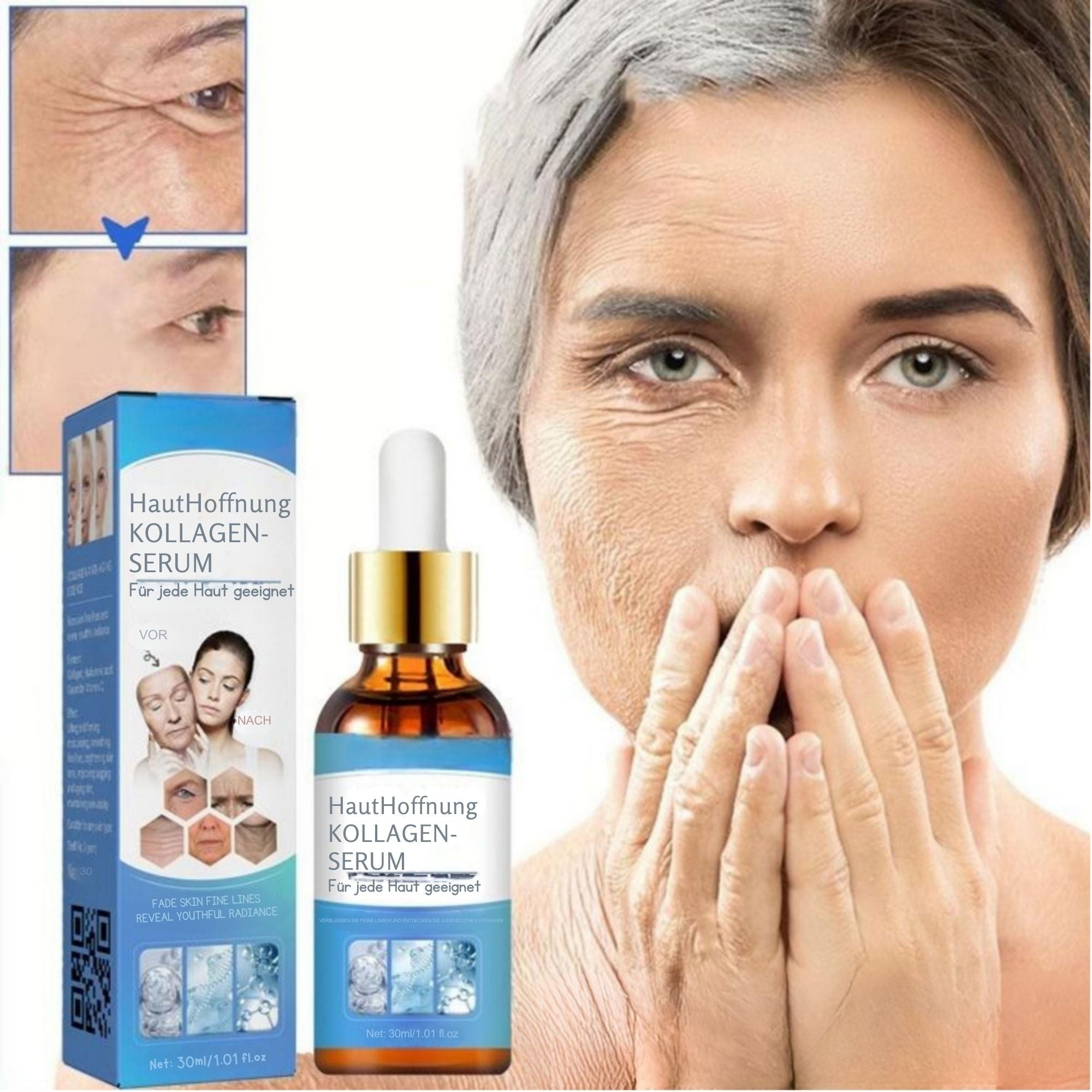 HautHoffnung™ / Für Ein Jüngeres Aussehen Ohne Operation (1+1 GRATIS)