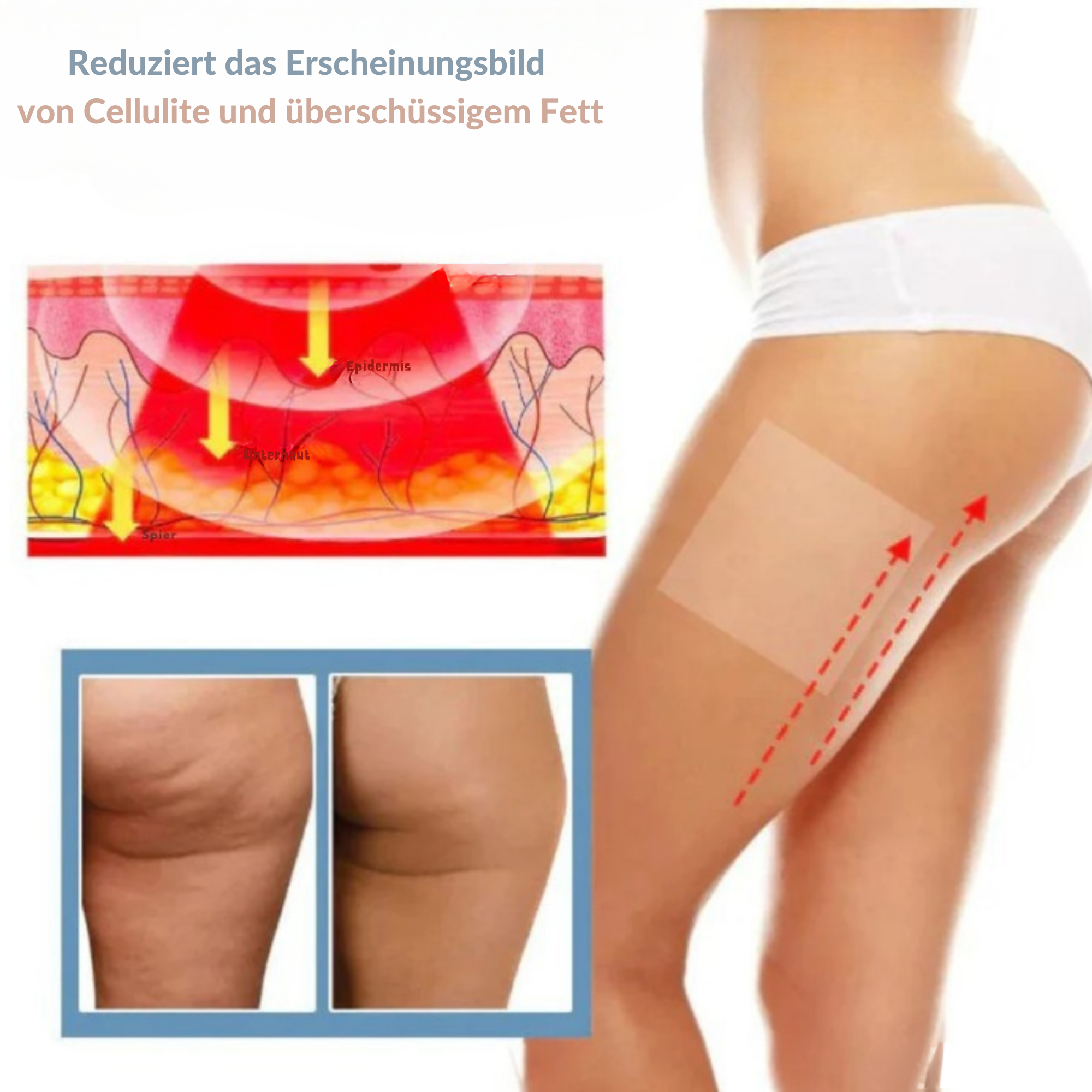 PatchPerfekt™/ Unsichtbare Kollagen-Pflaster Für Straffere Haut (1 + 2 GRATIS)