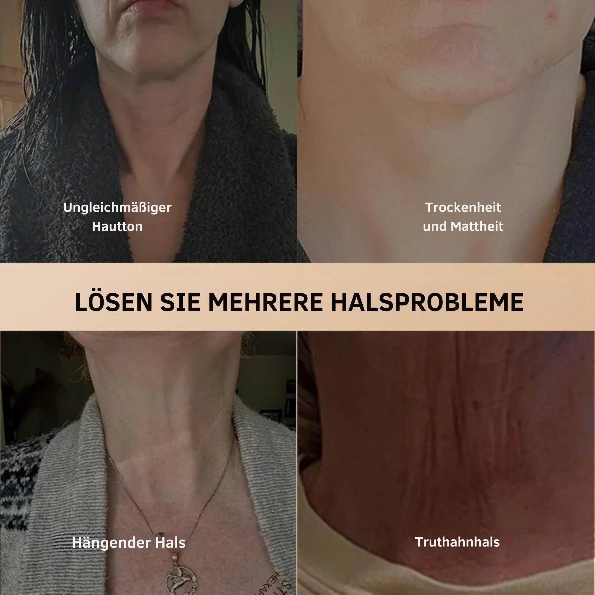 HalsHarmonie™ / Perfecte Halsversteviging (1+1 GRATIS)