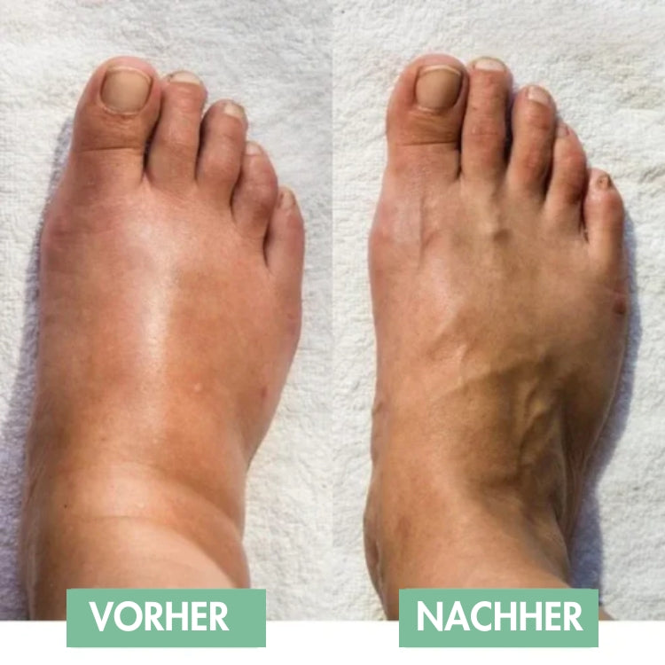 FußFrei™ / EMS Fußmassage Für Sofortige Linderung!