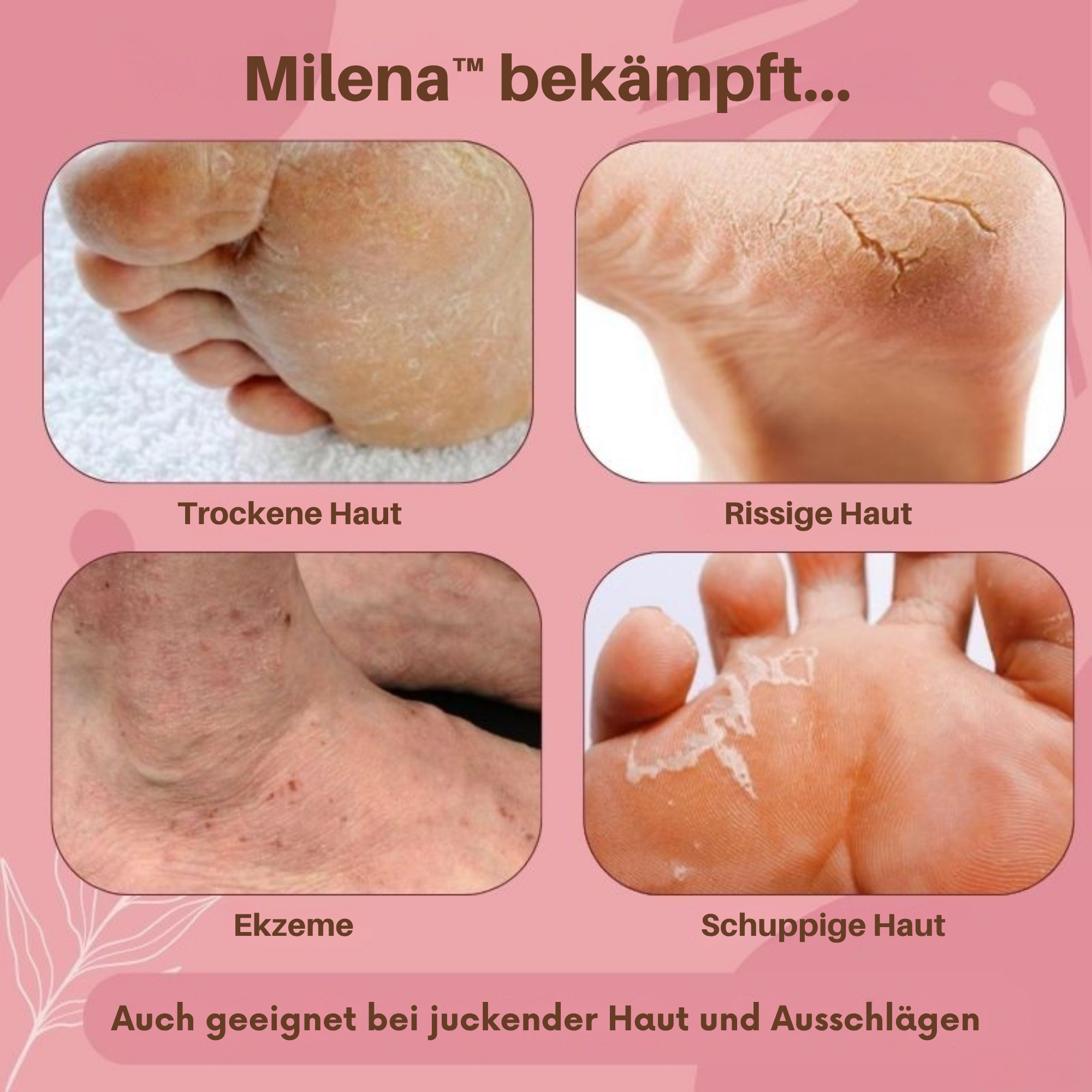 1+1 GRATIS | Milena - Fußerneuernde Pflegesalbe gegen Trockenheit, Geruch & Ekzeme