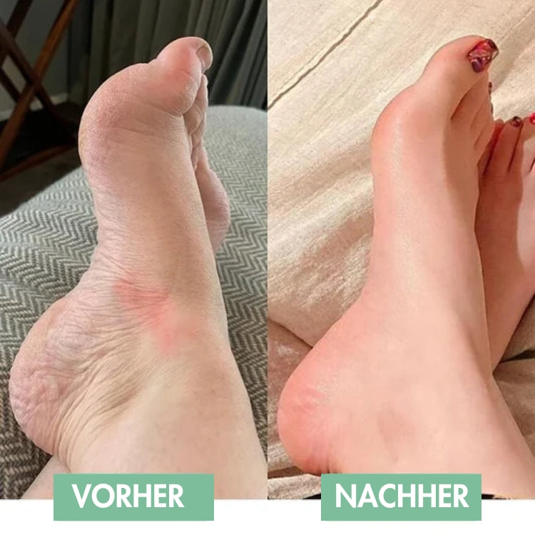FußFrei™ / EMS Fußmassage Für Sofortige Linderung!