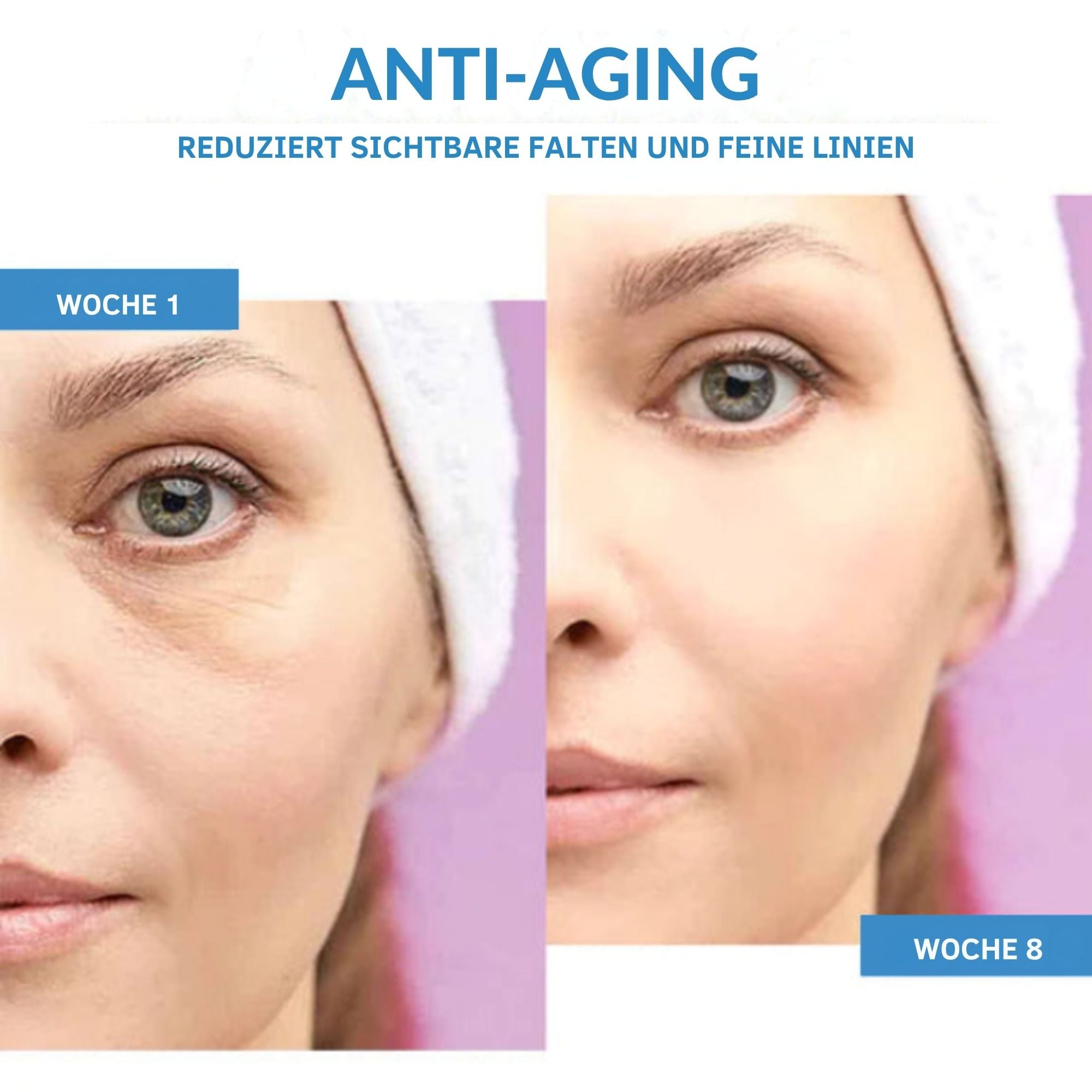 StrahlStich™ / Strahlende, Junge Und Erfrischte Augen! (1+1 GRATIS)